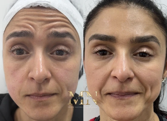 clinica-de-estetica-em-londres (3)