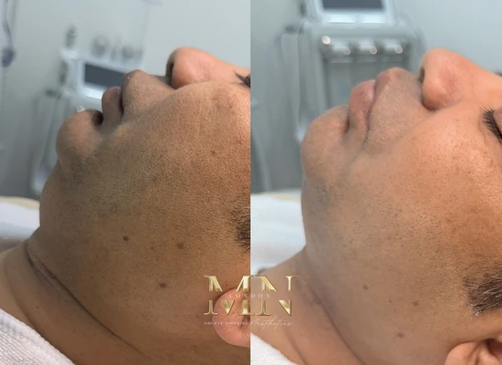 clinica-de-estetica-em-londres (4)