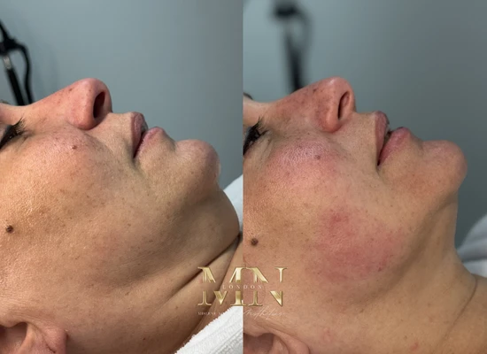 clinica-de-estetica-em-londres (5)